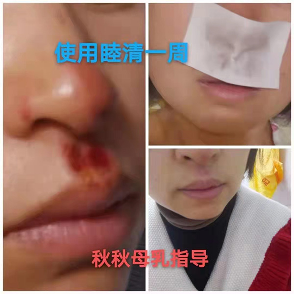 �����澏���N���Æ������M(f��i)�߿ڱ���������(sh��)���a(ch��n)ƷȦ�۟o��(sh��)